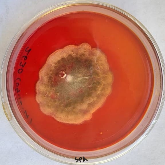 41. Basidiobolus Spp.